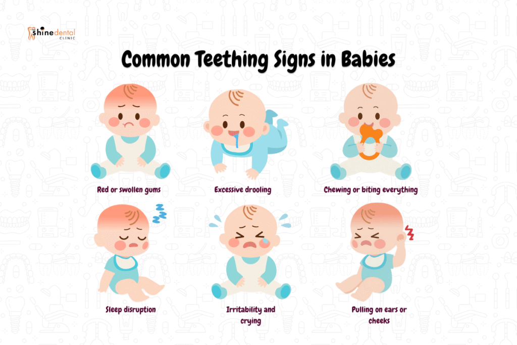 Infographics of common teething signs in babies 