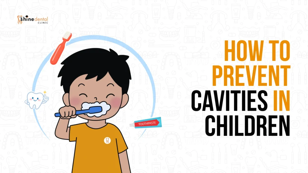 Infographics of the shine dental clinic on how to prevent cavities in children