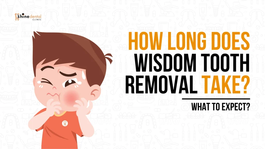 Wisdom teeth removal infographics of the shine dental clinic