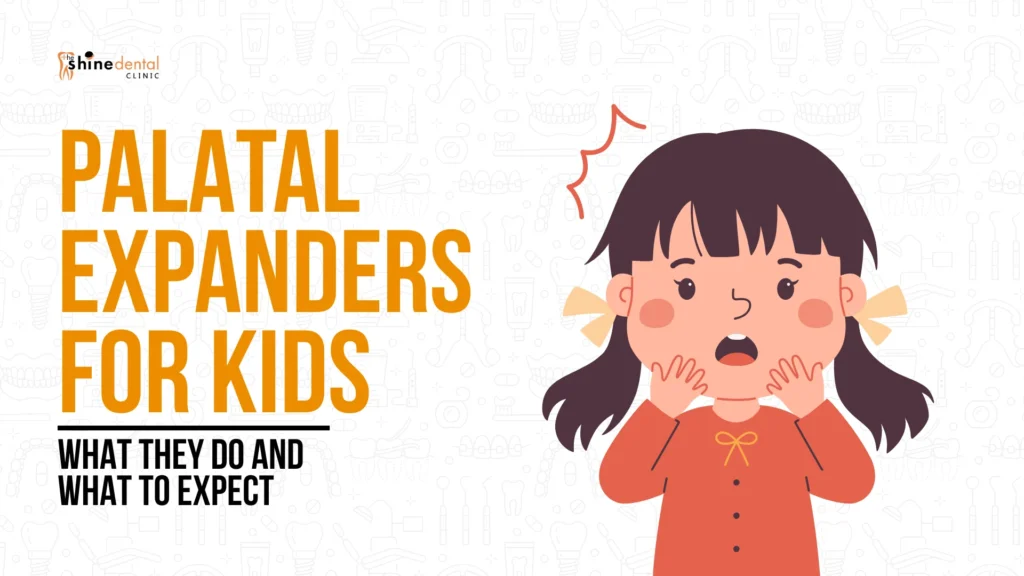 explaining palatal expanders for kids, what they do and what to expect