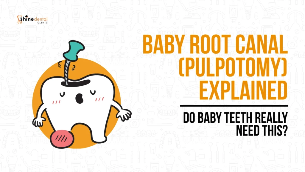 Illustration explaining baby root canal (pulpotomy) and whether baby teeth really need this