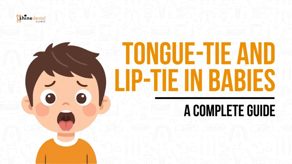 Complete guide illustration on tongue-tie and lip-tie in babies